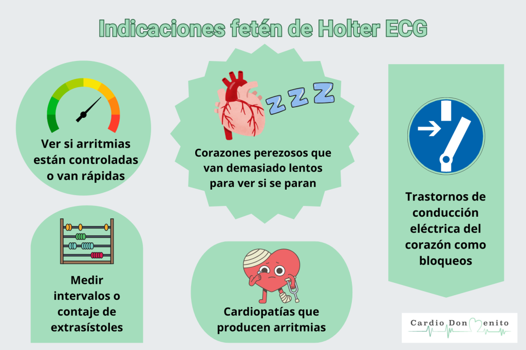 Indicaciones del Holter ECG