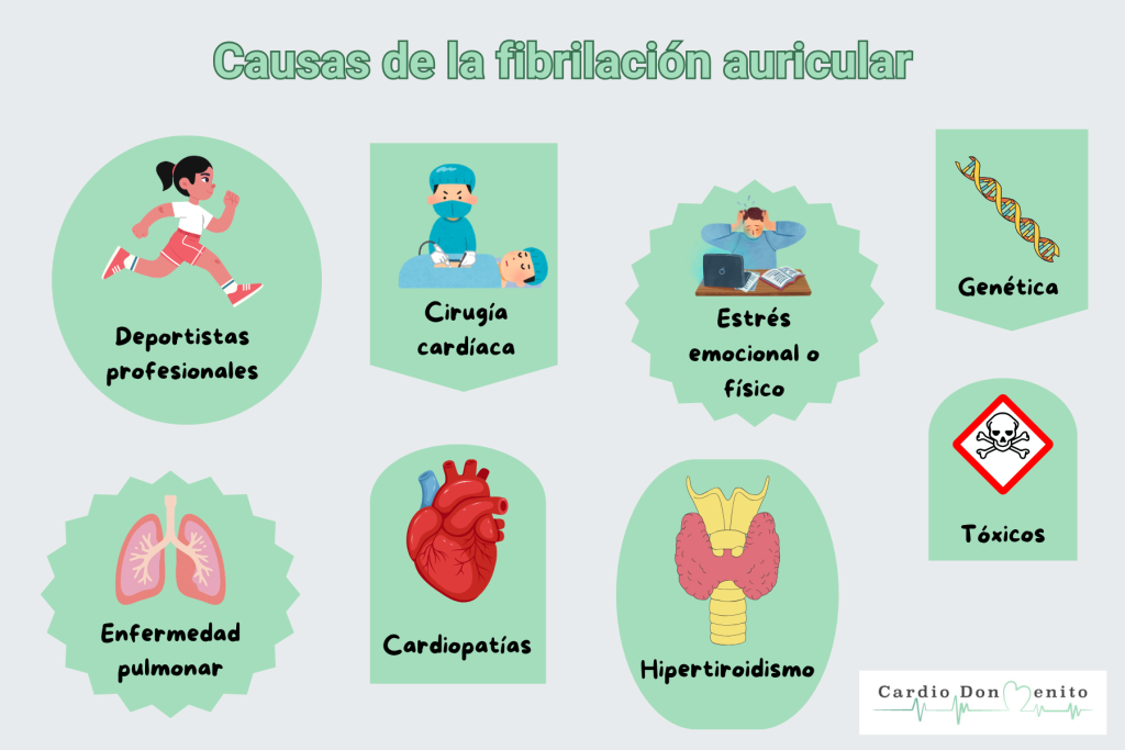 Causas de la fibrilación auricular